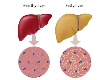 The Silent Killer: A Guide to Fatty Liver Disease in Chinchillas