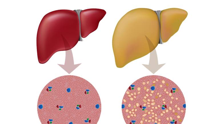 The Silent Killer: A Guide to Fatty Liver Disease in Chinchillas